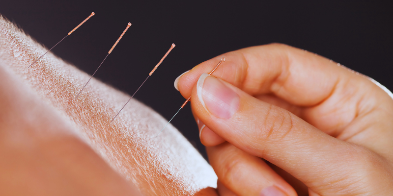 Acupuntura: Harmonia Energética